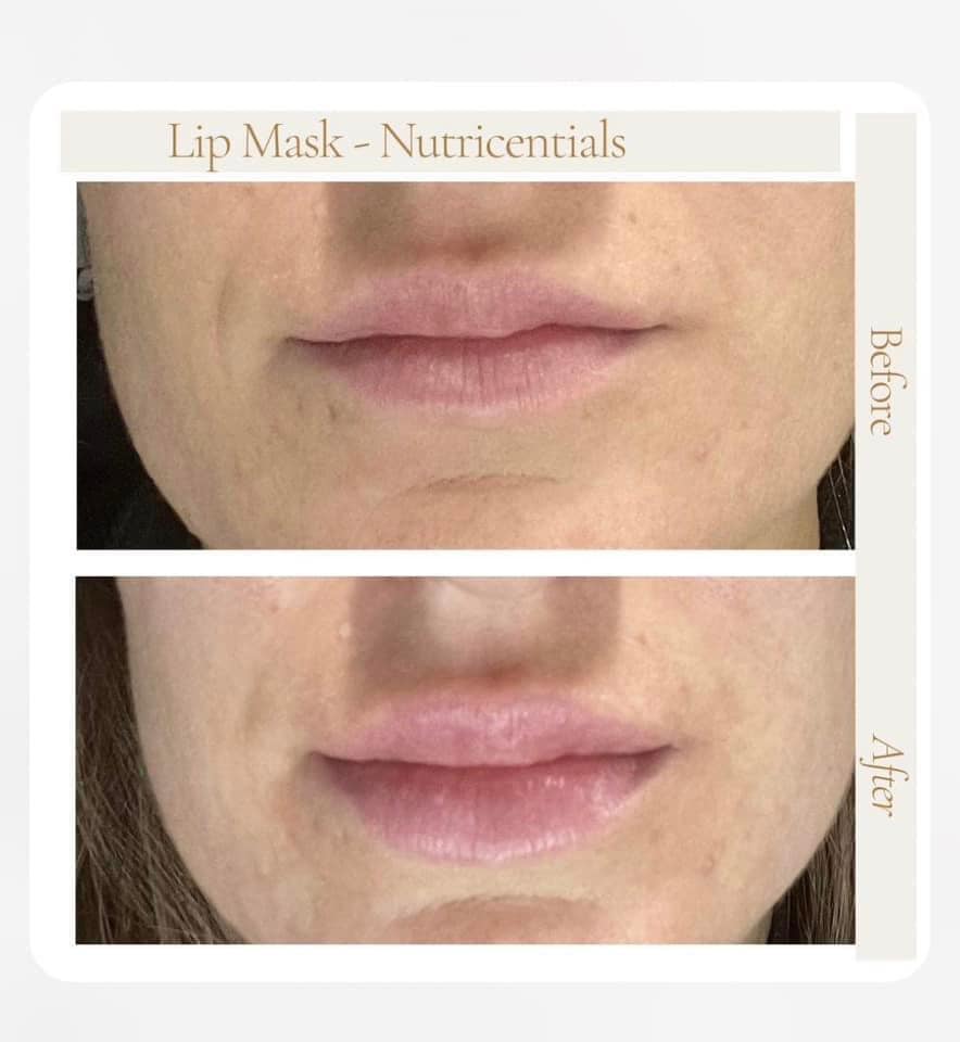 Gold Nutricentials Vit C + Lip Mask