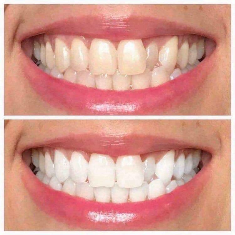Whitening Toothpaste