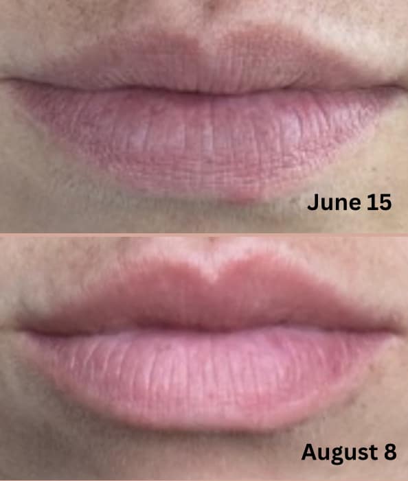Lip Peptide