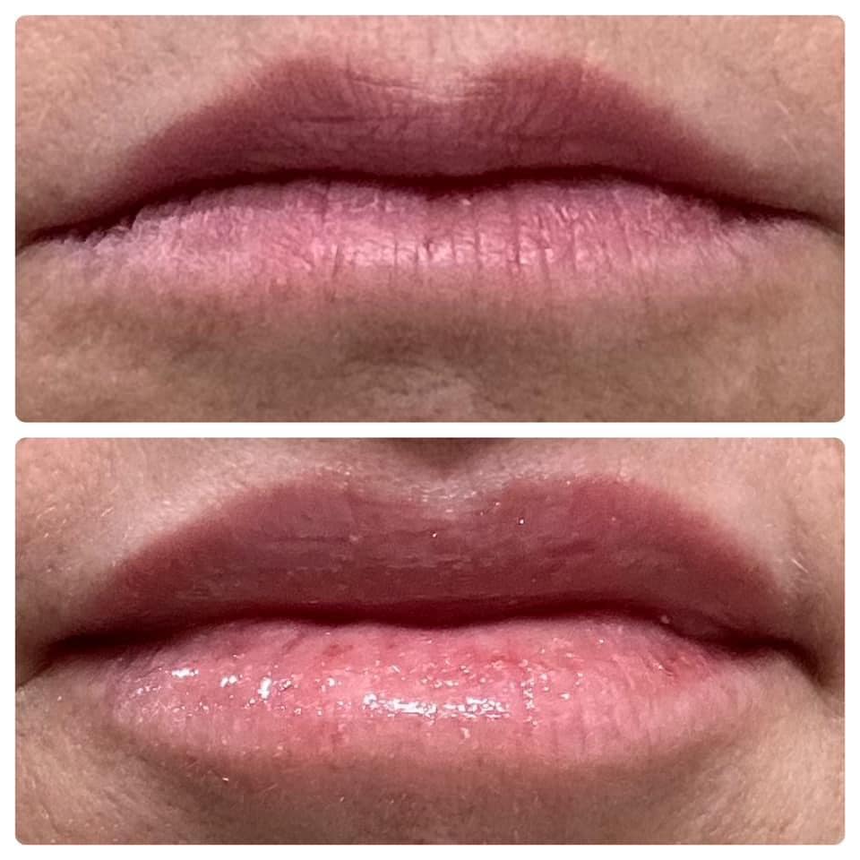 Lip Peptide