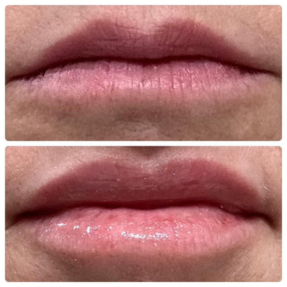 Lip Peptide