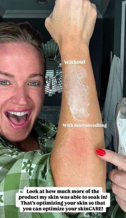 NEW!! - Microneedling Tool + Line Corrector Bundle