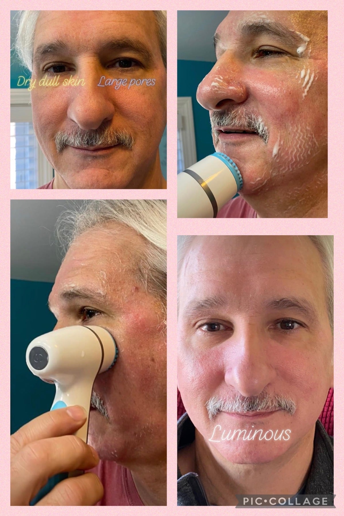 Lumispa iO Bundle + FREE Pillow Glow Facial Moisturizer