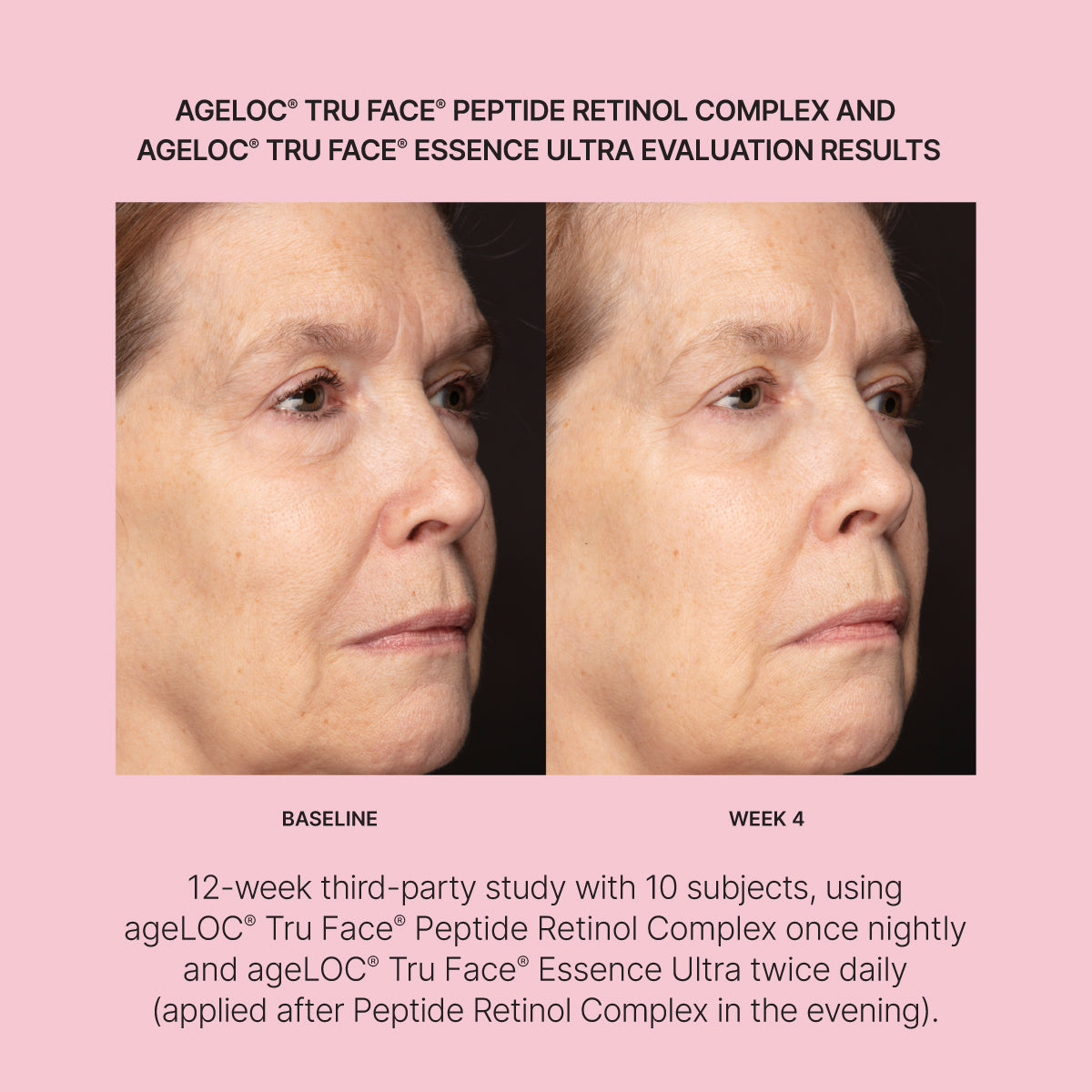 NEW!! - Microneedling Tool + Line Corrector Bundle