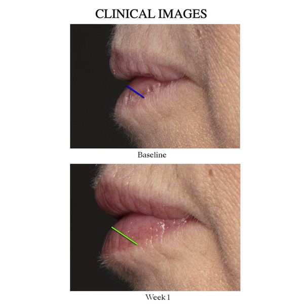 Lip Peptide