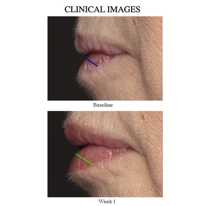 Lip Peptide
