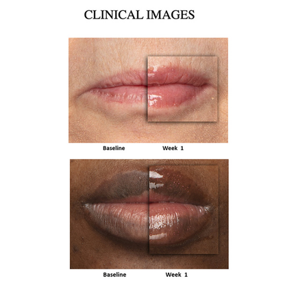 Lip Peptide